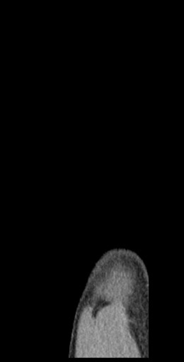 Schwarze und weiße MRI-Aufnahme eines Mannes, die detaillierte Hirnstruktur zeigt.